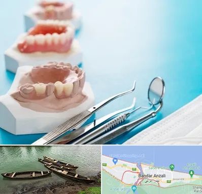 متخصص روکش دندان در بندر انزلی