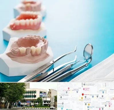 متخصص روکش دندان در طالقانی 