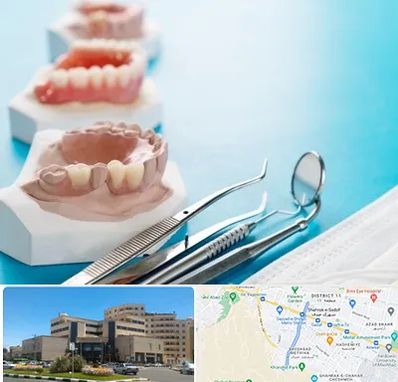 متخصص روکش دندان در صیاد شیرازی مشهد 