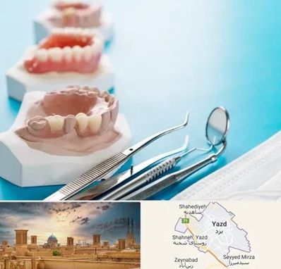 متخصص روکش دندان در یزد