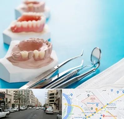متخصص روکش دندان در زیتون کارمندی اهواز 