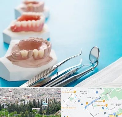متخصص روکش دندان در محلاتی شیراز