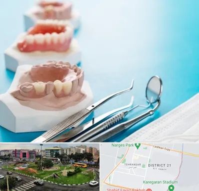 متخصص روکش دندان در تهرانسر 