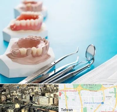 متخصص روکش دندان در مرزداران 