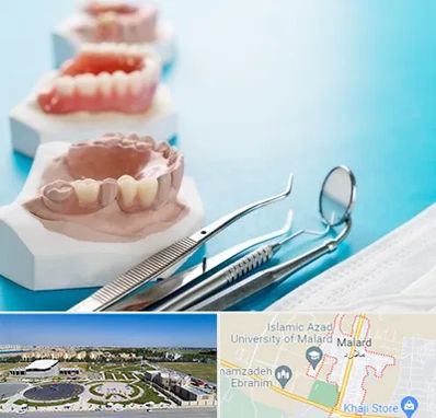 متخصص روکش دندان در ملارد