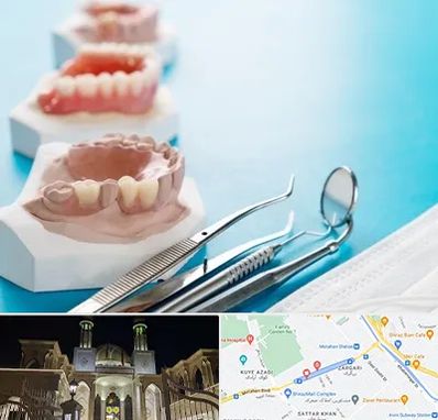 متخصص روکش دندان در زرگری شیراز 
