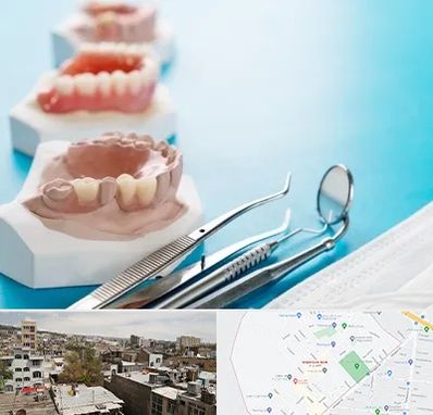 متخصص روکش دندان در شمیران نو 