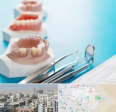 متخصص روکش دندان در منطقه 14 تهران 