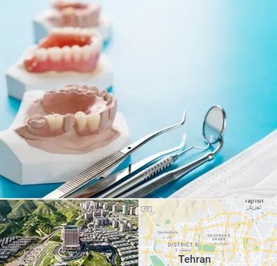 متخصص روکش دندان در شمال تهران 