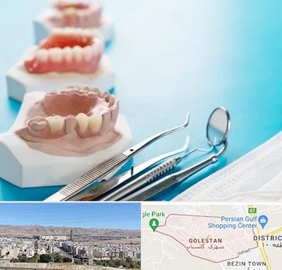 متخصص روکش دندان در شهرک گلستان شیراز 