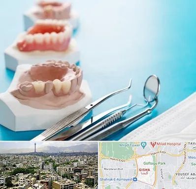 متخصص روکش دندان در گیشا 