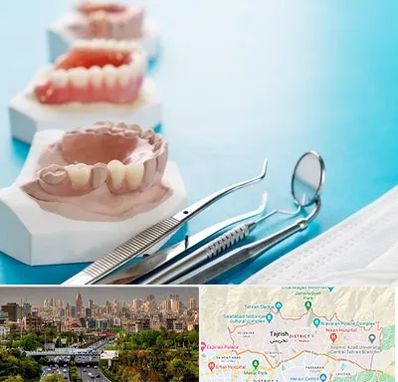 متخصص روکش دندان در منطقه 1 تهران 