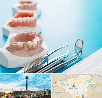 متخصص روکش دندان در تهران