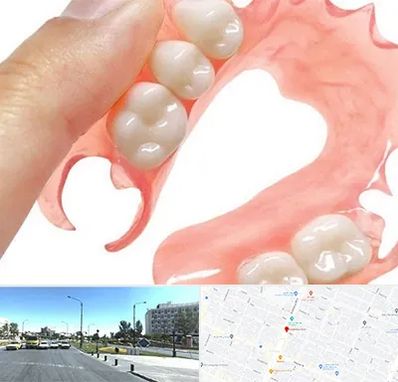 پروتز متحرک دندان در بلوار کلاهدوز مشهد 