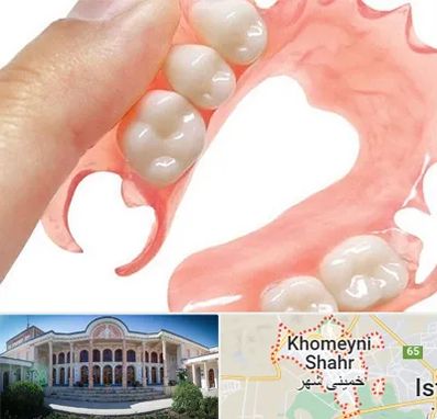 پروتز متحرک دندان در خمینی شهر