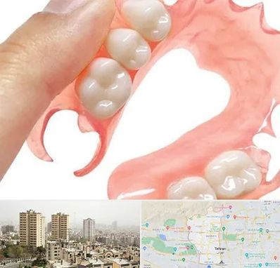 پروتز متحرک دندان در منطقه 5 تهران 