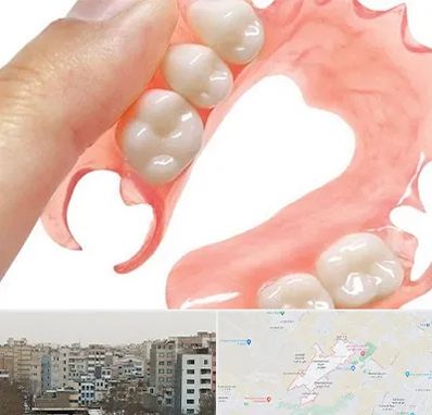 پروتز متحرک دندان در محمد شهر کرج 