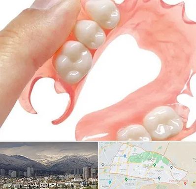 پروتز متحرک دندان در منطقه 4 تهران 