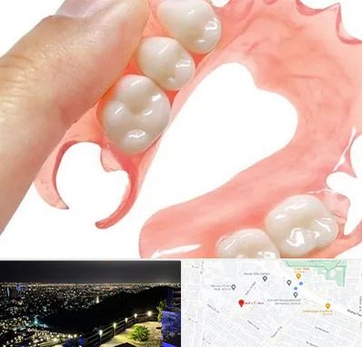 پروتز متحرک دندان در هفت تیر مشهد 