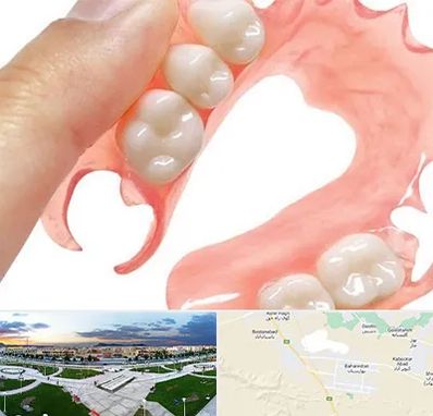 پروتز متحرک دندان در بهارستان اصفهان 