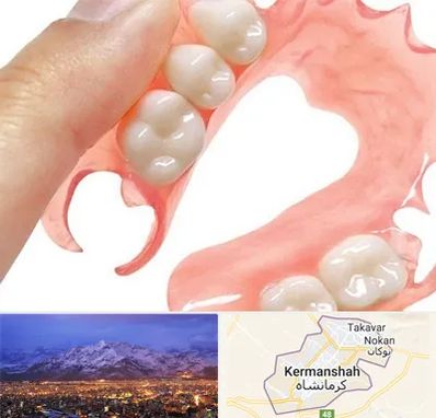 پروتز متحرک دندان در کرمانشاه