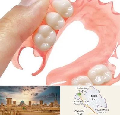 پروتز متحرک دندان در یزد