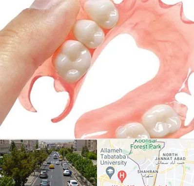 پروتز متحرک دندان در شهران 