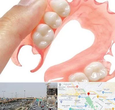 پروتز متحرک دندان در بلوار توس مشهد 