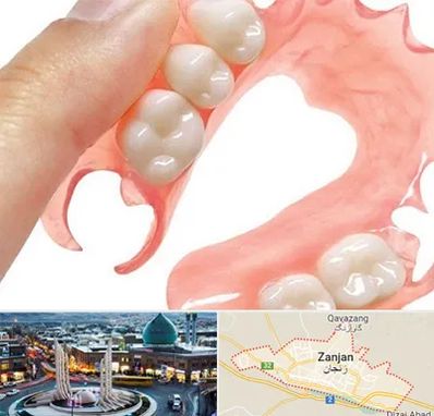 پروتز متحرک دندان در زنجان