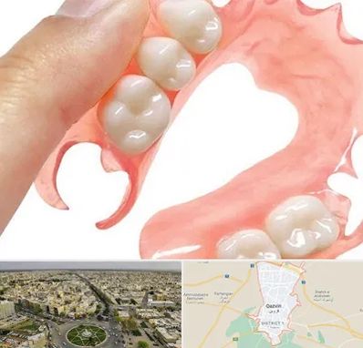 پروتز متحرک دندان در قزوین