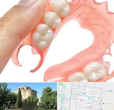 پروتز متحرک دندان در مرداویج اصفهان 