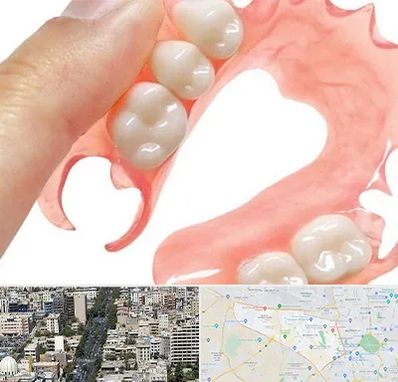 پروتز متحرک دندان در منطقه 18 تهران 