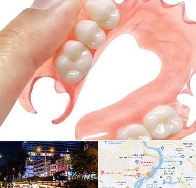 پروتز متحرک دندان در کیانپارس اهواز 