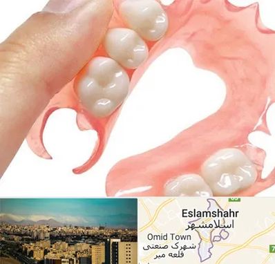 پروتز متحرک دندان در اسلامشهر