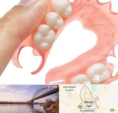 پروتز متحرک دندان در اهواز