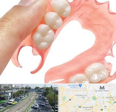 پروتز متحرک دندان در جنوب تهران 