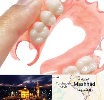 پروتز متحرک دندان در مشهد
