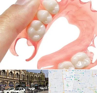 پروتز متحرک دندان در منطقه 11 تهران 