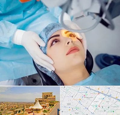 دکتر عمل لیزیک چشم در هاشمیه مشهد