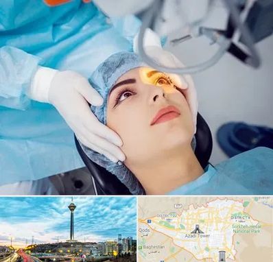 دکتر عمل لیزیک چشم در تهران