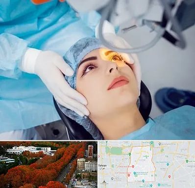 دکتر عمل لیزیک چشم در منطقه 6 تهران