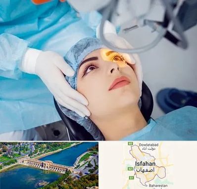 دکتر عمل لیزیک چشم در اصفهان