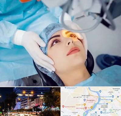 دکتر عمل لیزیک چشم در کیانپارس اهواز