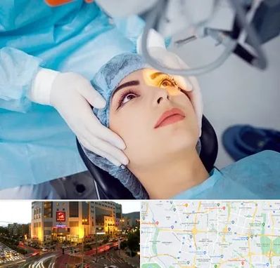 دکتر عمل لیزیک چشم در جنت آباد تهران