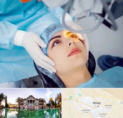 دکتر عمل لیزیک چشم در شیراز