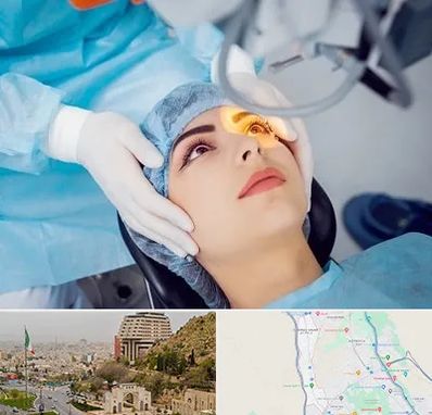 دکتر عمل لیزیک چشم در فرهنگ شهر شیراز