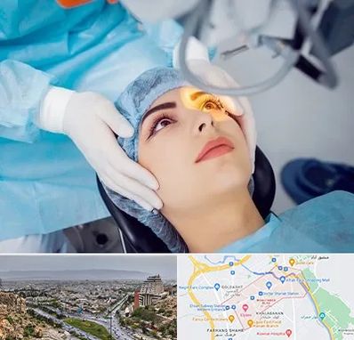 دکتر عمل لیزیک چشم در معالی آباد شیراز