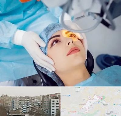 دکتر عمل لیزیک چشم در محمد شهر کرج