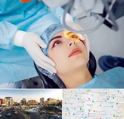 دکتر عمل لیزیک چشم در منطقه 7 تهران