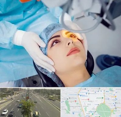 دکتر عمل لیزیک چشم در منطقه 17 تهران